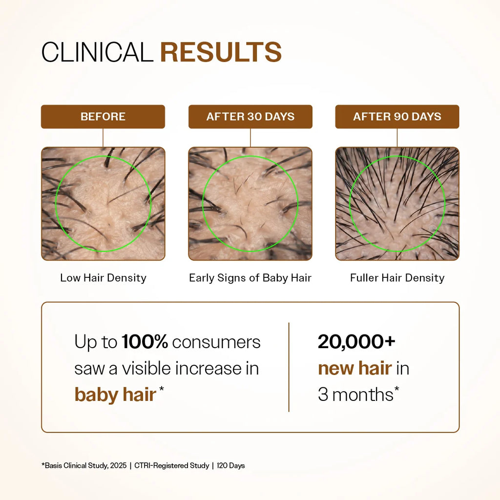 Advanced Hair Growth Serum With 3% Redensyl, 4% Anagain, & 1% Capilia Longa - 30 ml